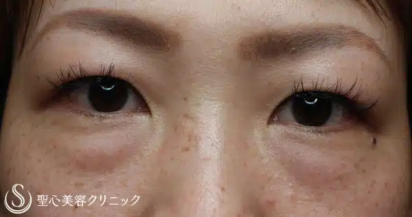 聖心美容クリニック